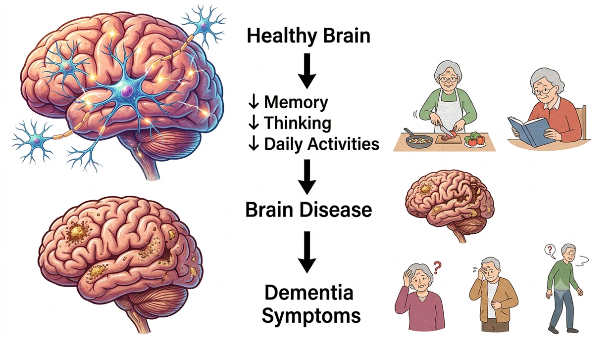 Dementia Care Delhi